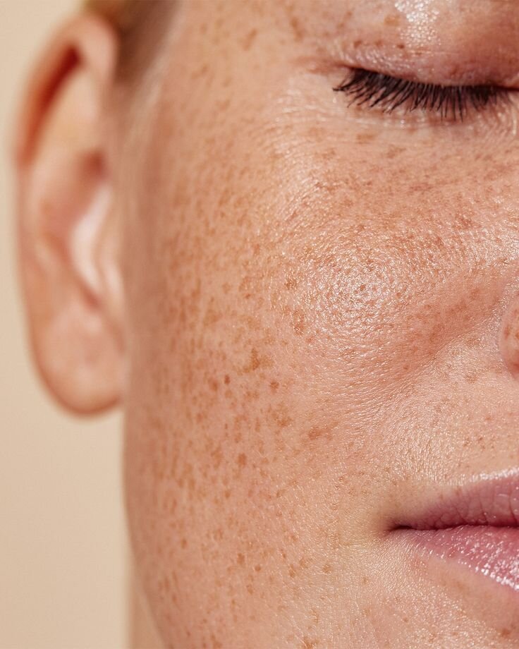 Revitalize Your Dry Skin: Expert Skincare Steps You Need